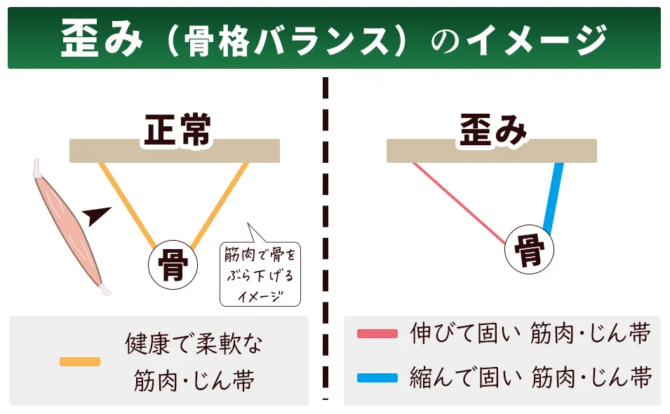骨格バランス簡易図、知立市ハート整体院
