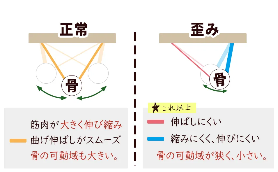 骨格バランス簡易図、知立市ハート整体院